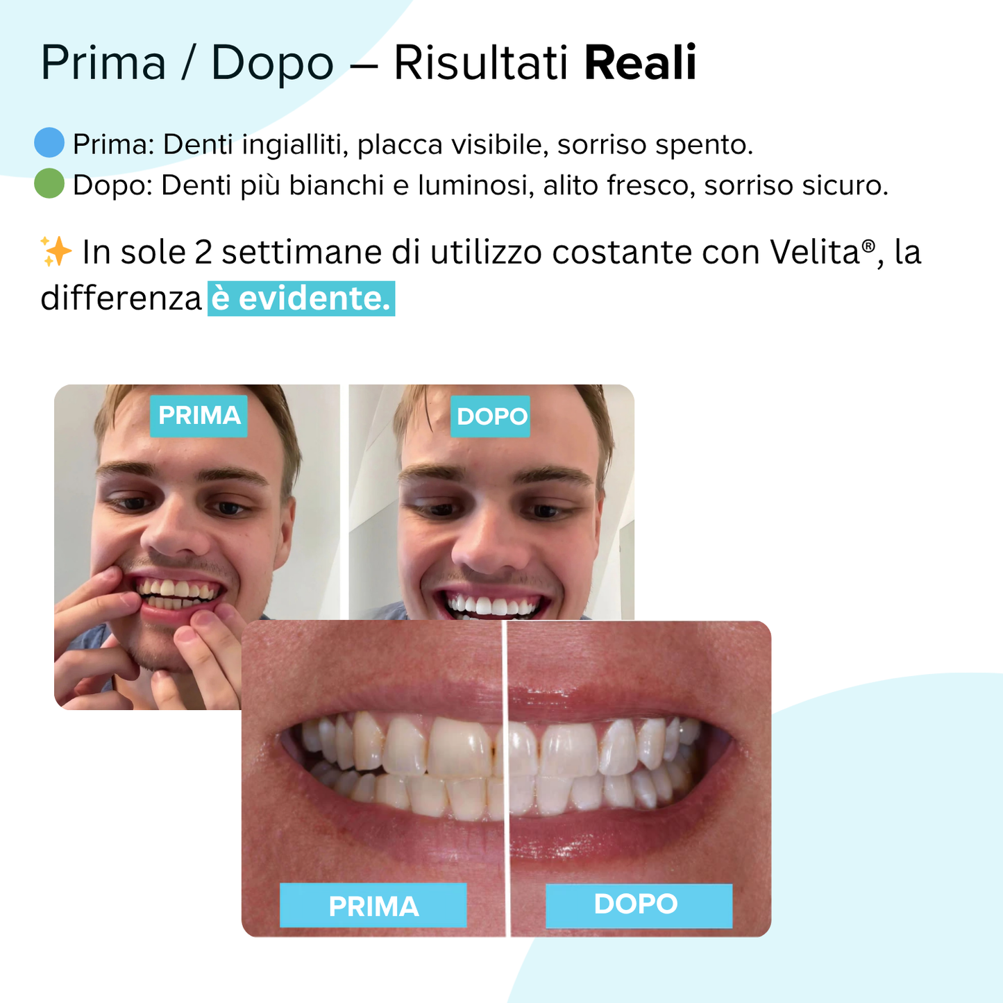 Velita® Spazzolino 360 - Velita